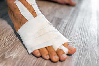 Broken Foot & Ankle Treatment Foot Fractures treatment