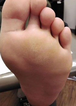Before SWIFT Treatment